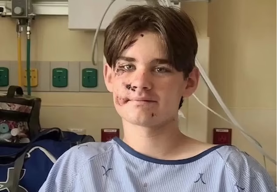 14-year-old boy miraculously survives 100ft fall into Grand Canyon